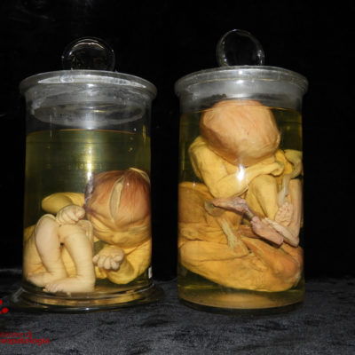 Feti-medicina legale
