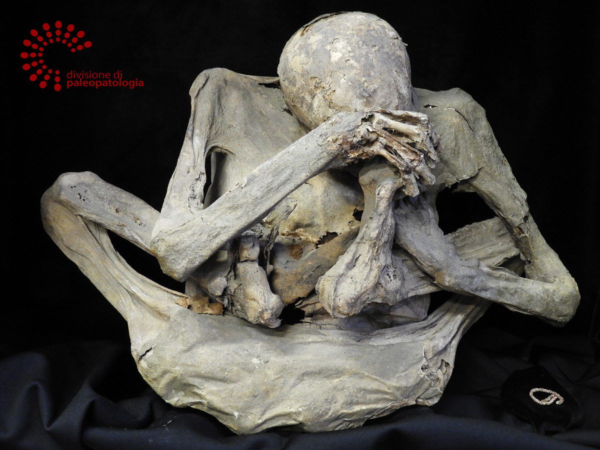 Mummia precolombiana
